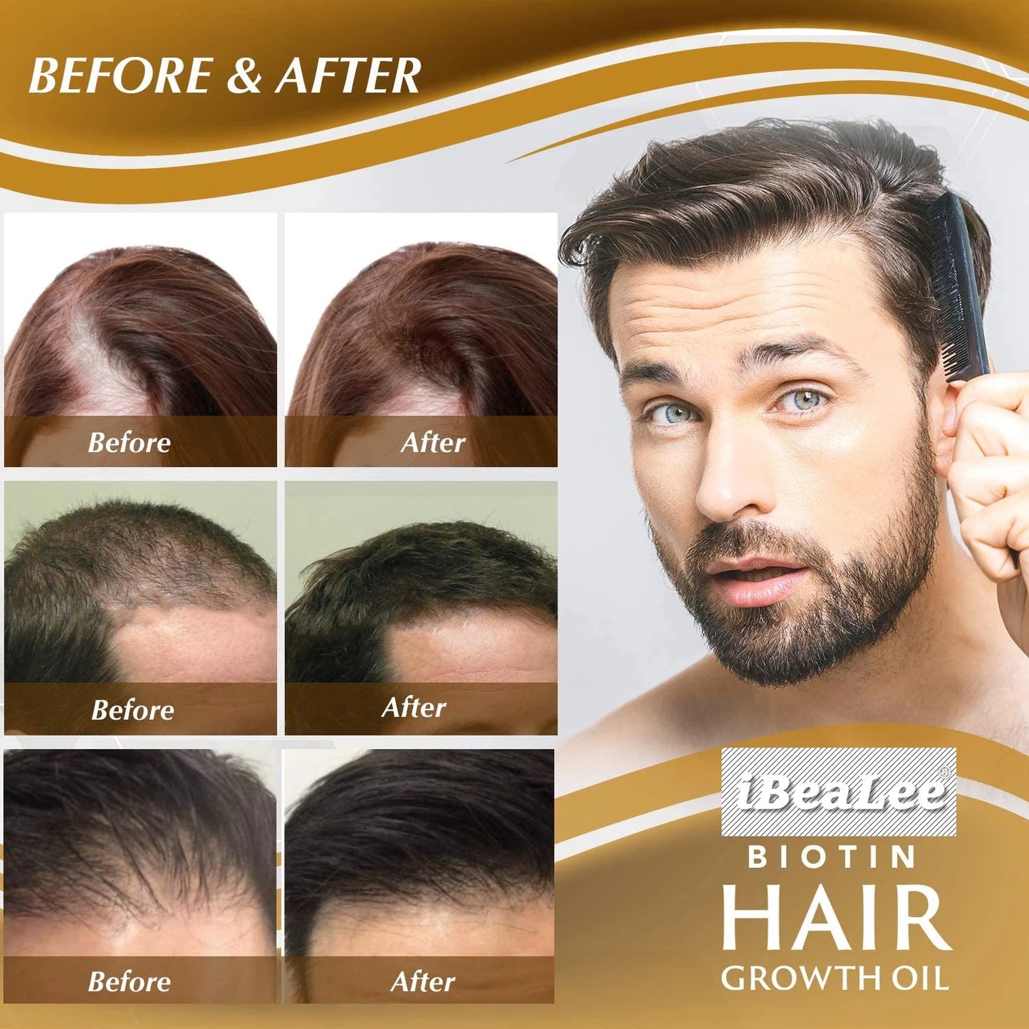 iBraLee anti-hair loss hair growth liquid solid hair increase hair care